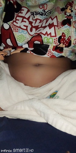 เครียดมากทำใจไม่ไดเลยวันนิ้ไปซาวมาหมอบอกว่าสงใสว่าแม่จะตั้งครรภ์ปลาอุก