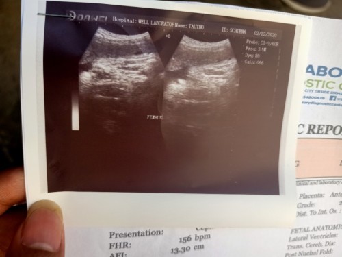 36 weeks and 3 days baby