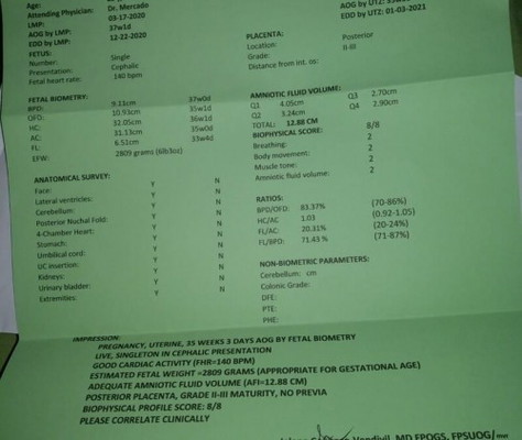 EDD LMP, TransV and BPS