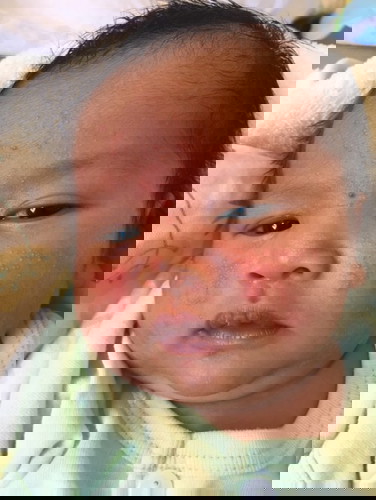 ลูกแพ้ไรไม่รู้ใช้ไรทาถึงดีขึ้นคะ