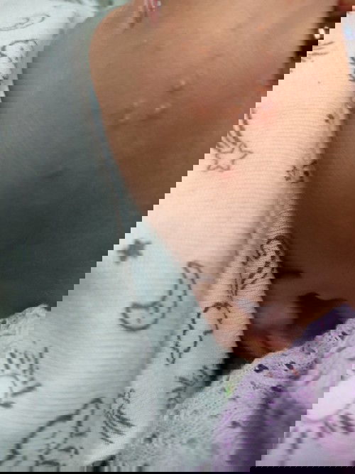 Ruam ke ni? Nak letak apa utk hilangkan