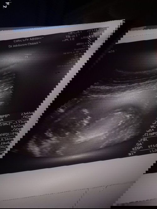 พอดูเพศออกปาวคับหรือรออายุครรภ์มากกว่านี้ก่อน