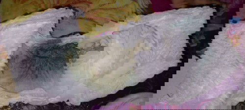 Mga mommy normal po ba ito?