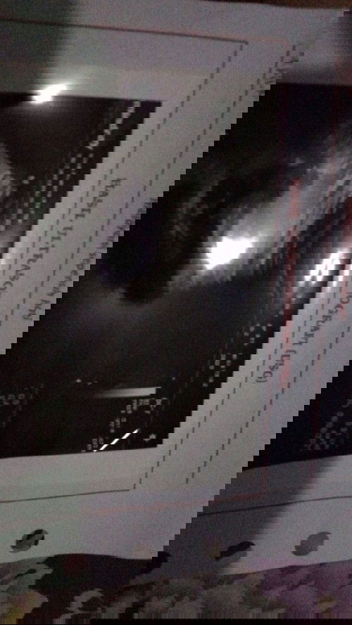 Hasil USG dr  kandungan