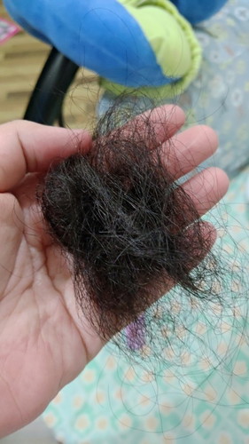 HAIR FALL / HAIR LOSS