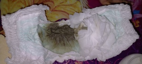 Normal po ba ganitong poop?