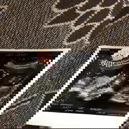 Boleh bagitahu tak kepala baby