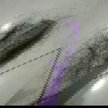 Rambut rontok setelah sc