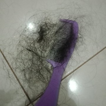 Rambut rontok setelah sc