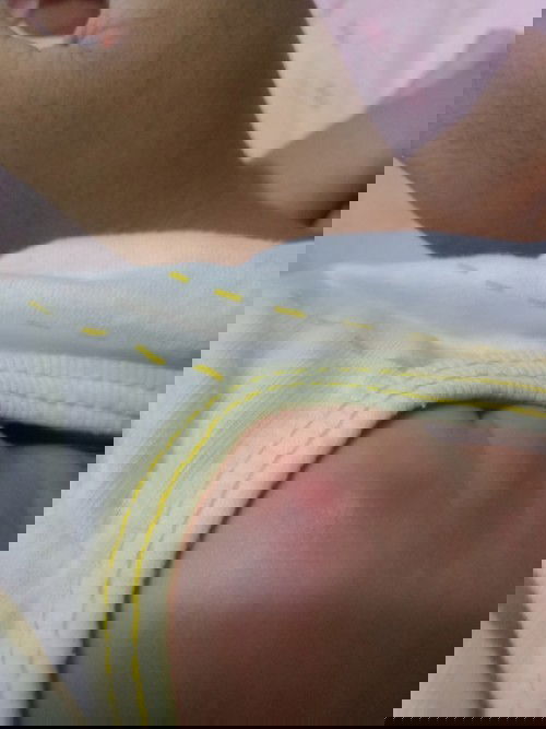 ลูกเป้นไรค่ะแบบนี้ใครรู้บ้างตอบหน่อยต้องทำไงค่ะ