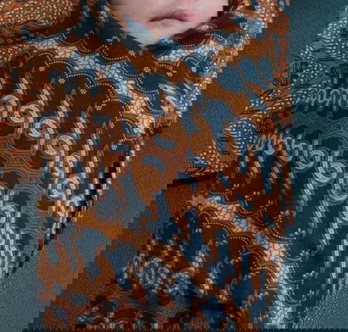 Lahiran Normal Dengan Varises Vagina