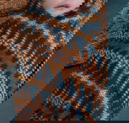 Lahiran Normal Dengan Varises Vagina