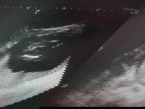 ขอดูใบซาวด์เพศหญิงแม่ๆหน่อยจ้า