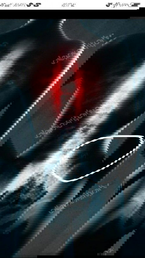 แม่แม่ท่านไหนมีอาการปวดหลังตามรูปบริเวณที่วงกลมปวดแบบจี๊ดๆเเละปวดมาเป็นพักๆบ้างค่ะ 
ท้องได้ 7weekค่ะ