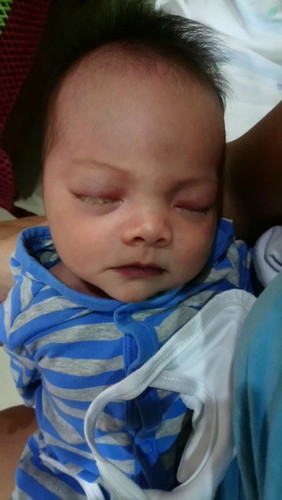 Nagmumutang mata ni baby