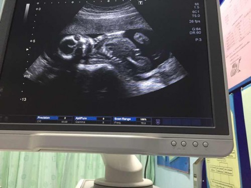 อยากรู้เพศน้องจังเลย 🥺