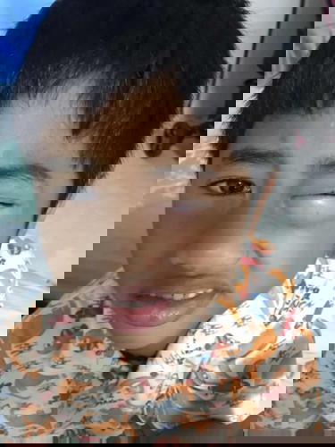 แพ้อาหารรึเปล่า?