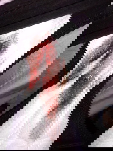 มีเลือดออกเยอะ