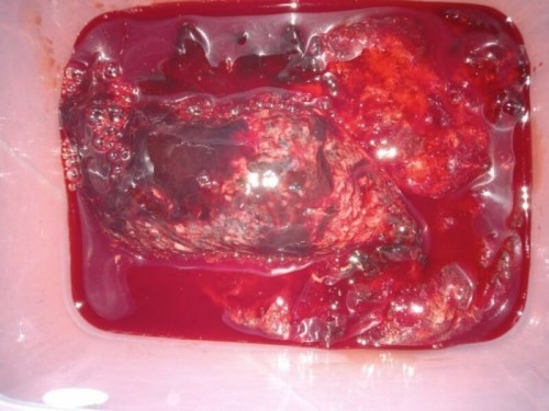 To my little guardian angel 😔