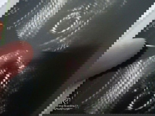 Hamil 15 Minggu tidak ada detak jantung