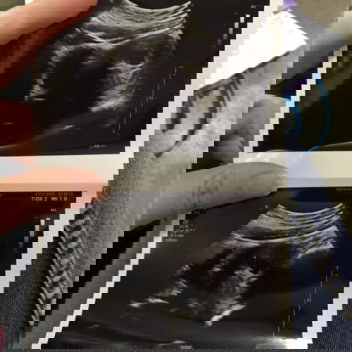 คุณแม่มือใหม่ค่ะ