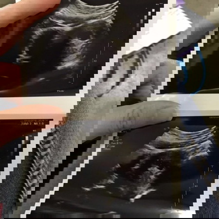 คุณแม่มือใหม่ค่ะ