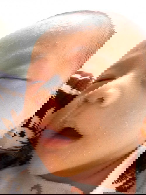 Bintik2 putih di wajah