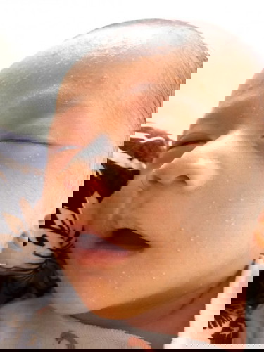 Bintik2 putih di wajah