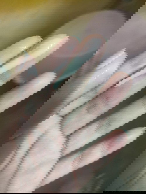 แบบนี้คือตกขาวหรือมูกค่ะ