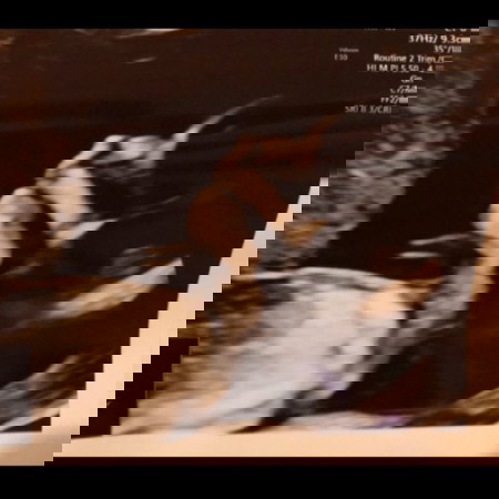 อาการแพ้ท้องช่วงแรก มีใครเป็นเหมือนแม่มั้ย