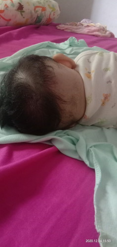 bunda" tau ga cara mengatasi rambut anak sepeeti ini? kasih tau dung bun" tif"nya๐
ada ga yg kaya g