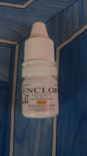 Telinga bby keluar cecair kuning