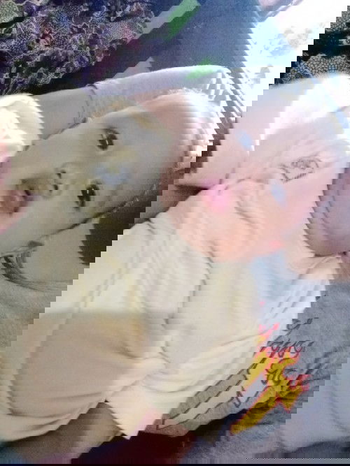 Pityriasis Alba 

?