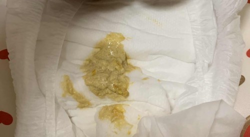 Baby’s odd poop colour