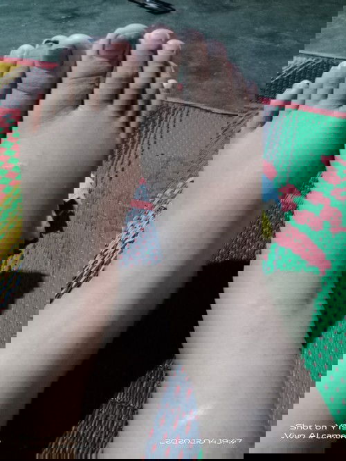 Pergelangan kaki dan kaki bengkak