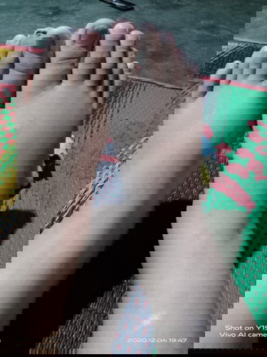 Pergelangan kaki dan kaki bengkak