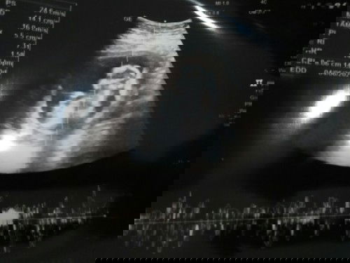 14สัปดาห์แล้วนะ