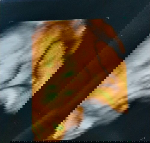 3D/4D ULTRASOUND