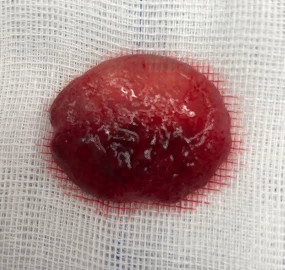 PERIOD DISCHARGE