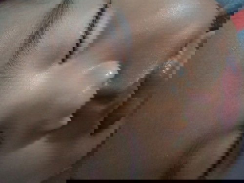 Sekeliling mata Kiri bayi memutih