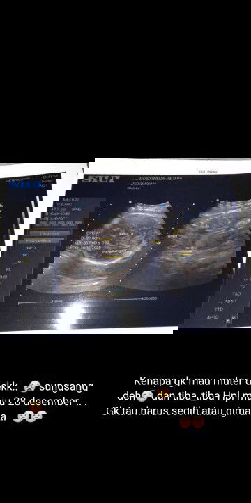 Usia 36 weeka tapi masih susngsang