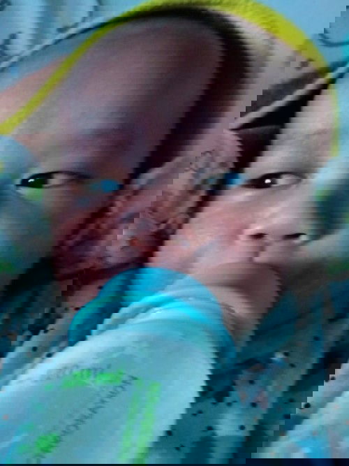 ลูกน่าแตกและแดงทำไงดี