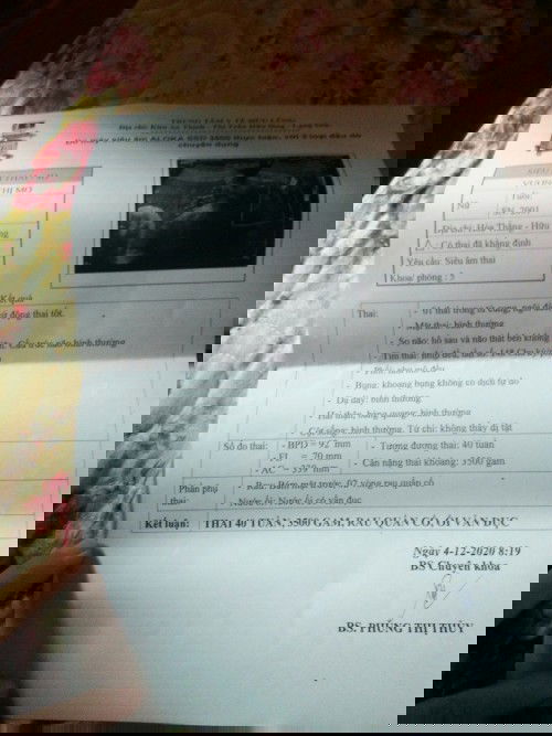 Các mom ơi, nay em đc 40w1d rồi, mẹ nào dễ đẻ con khỏe cho em xin vía để con mau ra với mình ạ,