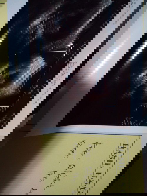 Flek 11 week, vonis BO