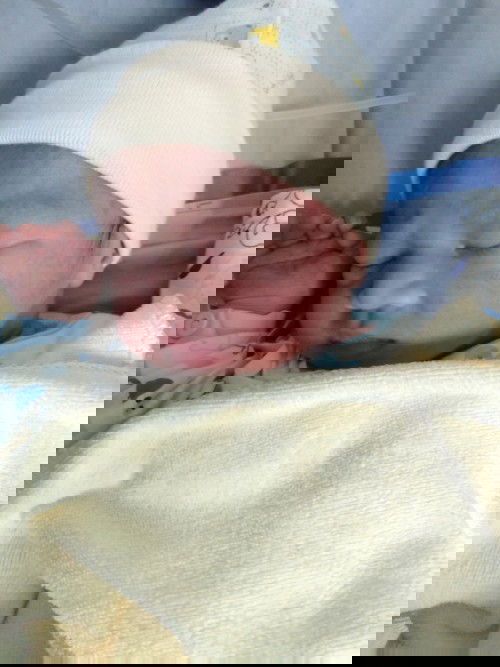 คลอดตามกำหนดเป๊ะเลย