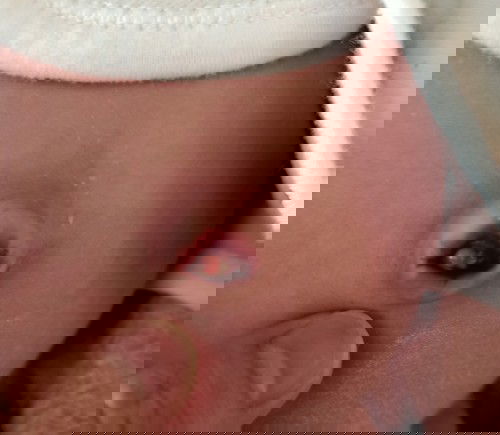 สดือน้องพึ่งหลุดเมื่อคืน เเต่ลักษณะแบบนี้ปกติไหมคะหรือว่าต้องไปหาหมอ