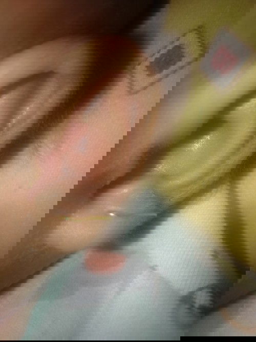 bun bantu jawb dong.ank ku sudh umr 1 buln 9 hri.tpi bulu" d kuping kyk gni kok gk hilang" ya😫ad yg tau gk ya cra menghilangkan ny?atau bsa hilng sendiri.klo lanugo kok sampe panjng" amt ya