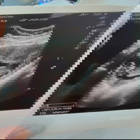 12w ของแม่ๆท่านอื่นเป็นไงบ้างค่ะมาแชร์กันค่ะ