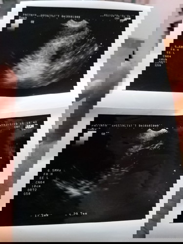 ปจดครั้งสุดท้าย 18ต.ค.ค่ะ ไปซาวด์มาแล้วไม่เจอน้องค่ะ จิตตก