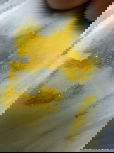 Blood sa poop ni baby